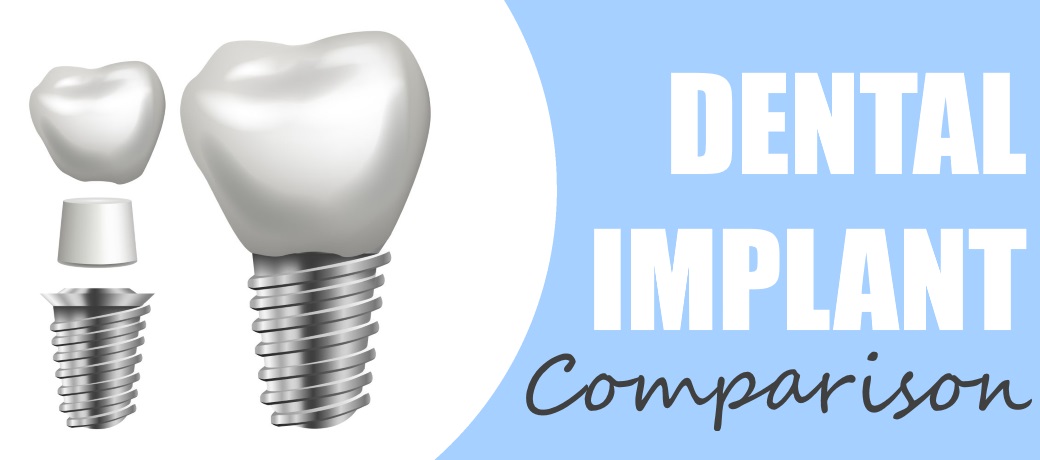 dental implant comparison header image